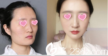 北京圣嘉荣黄大勇改脸型<span style= 北京圣嘉荣黄大勇改脸型<span style=