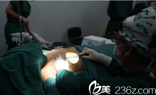 <!--<i data=20240703-sp></i>-->整形医院李映雨内窥镜娜琦丽假体隆胸手术过程图 <!--<i data=20240703-sp></i>-->整形医院李映雨内窥镜娜琦丽假体隆胸手术过程图