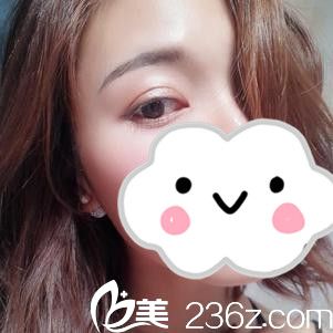 在赣州华美做双眼皮39天了 在赣州华美做双眼皮39天了