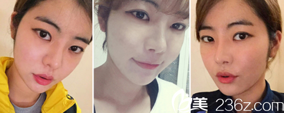 现在我越看眼睛和鼻子越顺畅