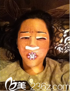 金智勋院长给我做完手术当天 金智勋院长给我做完手术当天