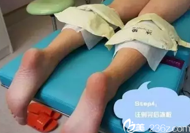 注射完瘦腿之后冰敷