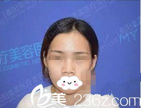 手术前正面照 手术前正面照