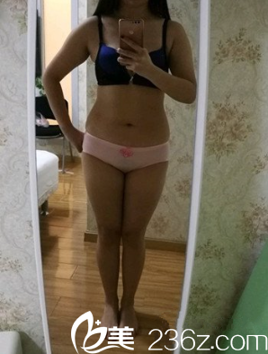 术前的我 术前的我