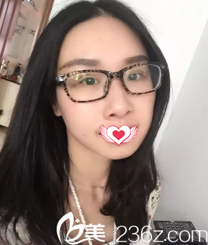 刚做完双眼皮手术眼睛肿胀 刚做完双眼皮手术眼睛肿胀