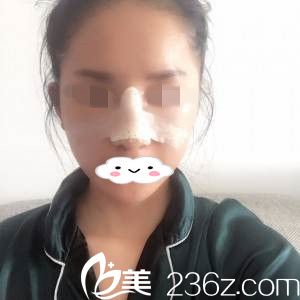 术后第二天 术后第二天