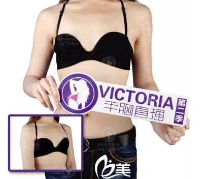 术前术后丰胸对比案例