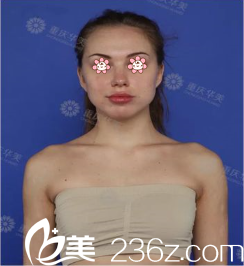 我的术前照 我的术前照