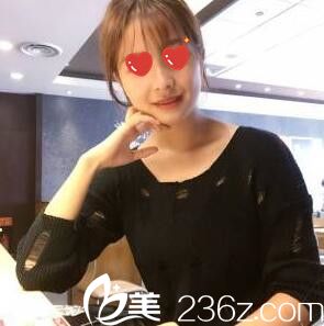 脂肪填充全脸半个月情况