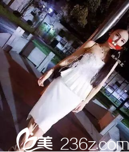 贵阳美莱梁洁假体隆胸术后两个月 贵阳美莱梁洁假体隆胸术后两个月