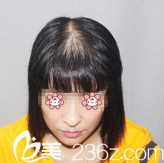 嫌头发少我专门做了齐<!--<i data=20240703-sp></i>--> 嫌头发少我专门做了齐<!--<i data=20240703-sp></i>-->