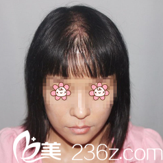 去重庆时光整形医院前的我 去重庆时光整形医院前的我