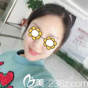 在长沙艾依美做过一次双眼皮的我这次又来找金鹏院长给我做自体脂肪填充面部