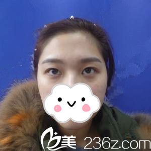 手术前的我 手术前的我