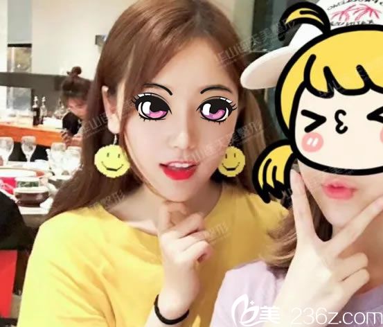 鼻部奥美定取出后15天效果 鼻部奥美定取出后15天效果