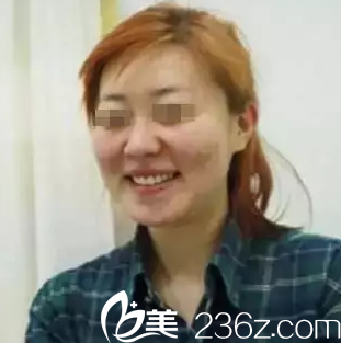 我在<!--<i data=20240703-sp></i>-->整形医院做面部线雕提升前的照片 我在<!--<i data=20240703-sp></i>-->整形医院做面部线雕提升前的照片