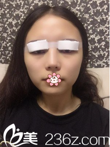 王志军医生帮我做完手术当天