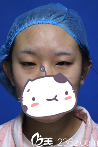 手术前照片 手术前照片