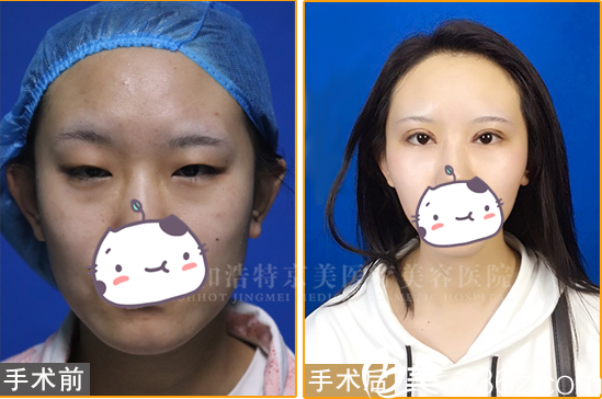 呼和浩特京美案例 呼和浩特京美案例