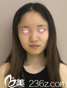 我的术前照 我的术前照