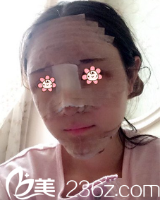 何山医生给我做完手术当天 何山医生给我做完手术当天