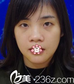 术前照,我的 术前照,我的