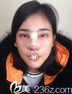 冯辉利院长给我做完手术第四天 冯辉利院长给我做完手术第四天