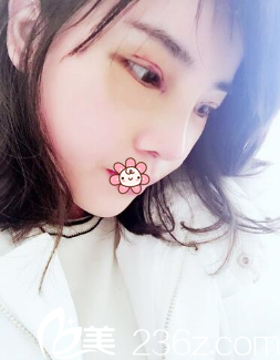 一周拆线 一周拆线