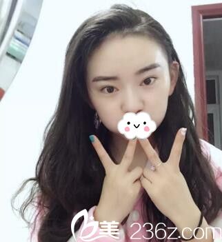 发际线种植一个月