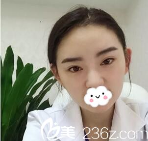 发际线种植四个月<span style=