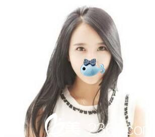 濮阳源美温赏面部脂肪填充恢复后 濮阳源美温赏面部脂肪填充恢复后