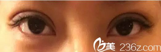 失败修复后第三天 失败修复后第三天