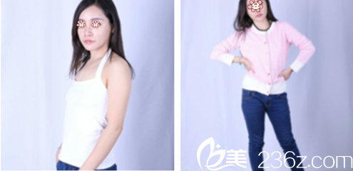 打算整形前我对比了新疆A优医美-王蛟整形和乌鲁木齐伊丽莎白整形 打算整形前我对比了新疆A优医美-王蛟整形和乌鲁木齐伊丽莎白整形