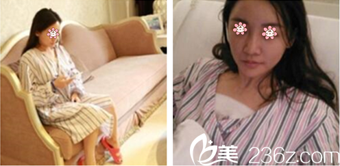 张宝誉主任给我术后第三天 张宝誉主任给我术后第三天