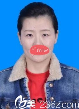 年轻时单眼皮的样子 年轻时单眼皮的样子