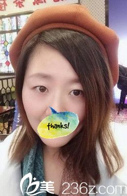 双眼皮术前素颜照 双眼皮术前素颜照