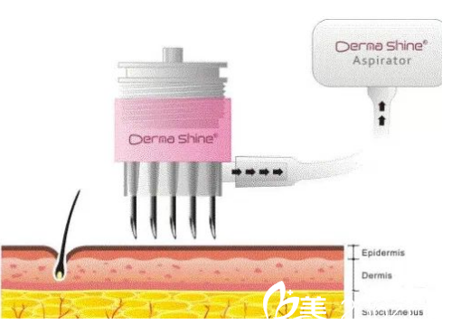 长春莱美注射多少钱？1120元起帮你塑造水光肌