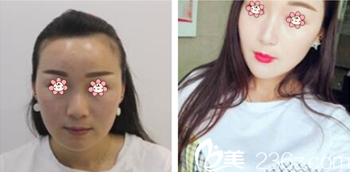 申东敏院长面部轮廓案例 申东敏院长面部轮廓案例