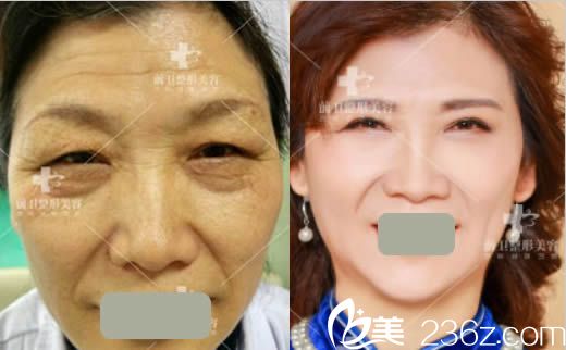 宜昌前卫整形皮肤年轻化案例图