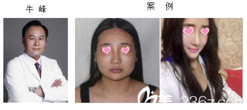 我拿到一份北京八大处磨骨下颌角改脸型医生名单含案例和近期整形优惠价格