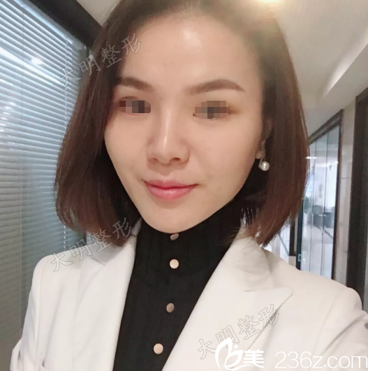 连云港大明整形张培鉴院长分享：3D全面部线雕+下颌缘提升真人案例，抗衰除皱联合运用效果更好