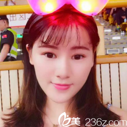 在<!--<i data=20240703-sp></i>-->整形医院做完线雕埋线提升三个月了 在<!--<i data=20240703-sp></i>-->整形医院做完线雕埋线提升三个月了