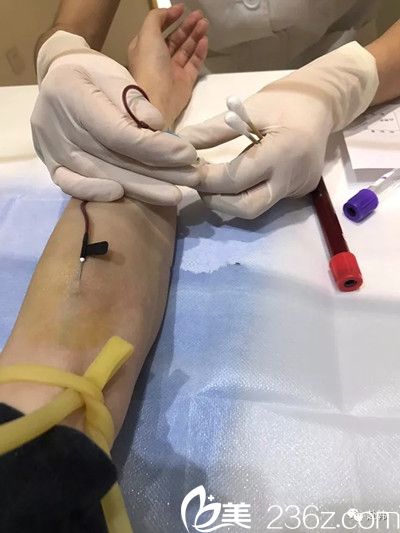 医院抽血真实照片图片