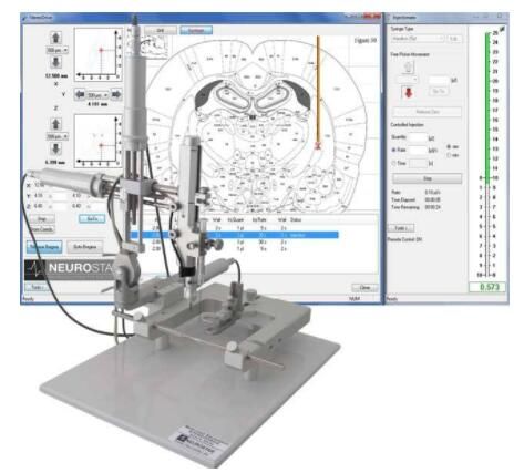 韩国黄金比整形外科3D影像骨定位系统 韩国黄金比整形外科3D影像骨定位系统
