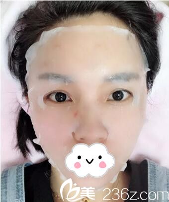 长沙美莱注射后敷面膜