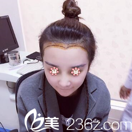 术前设计 术前设计