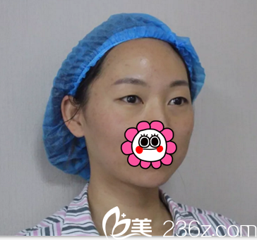 术前眼睛无神想做双眼皮 术前眼睛无神想做双眼皮