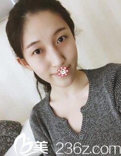 我的术前照 我的术前照