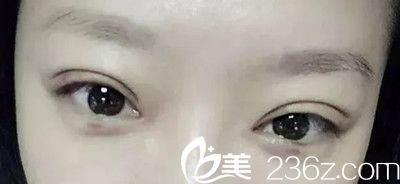 20180803_1533290032844373.jpg 6.webp.jpg