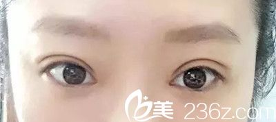 20180803_1533290064818654.jpg 8.webp.jpg